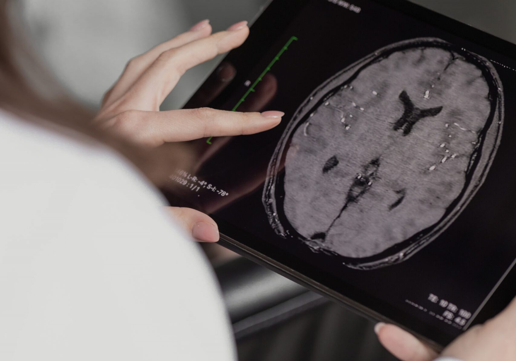 r3-website-mri